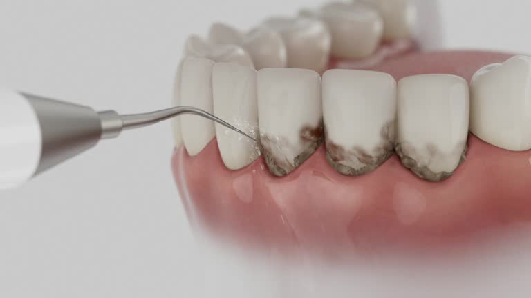 Reliable Dental Crowns And Bridges contractor in Burke County County, ND by Dentist Open Now